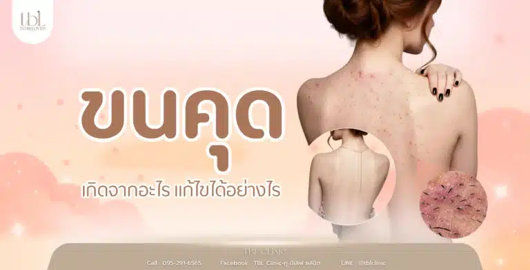 ขนคุด