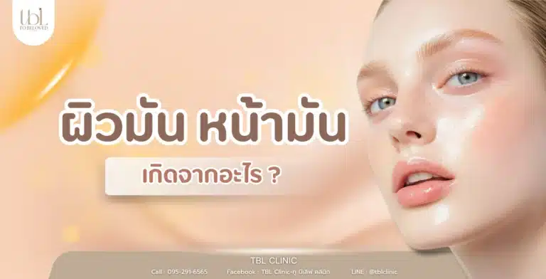 หน้ามัน