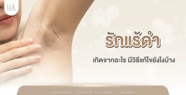 รักแร้ดำ