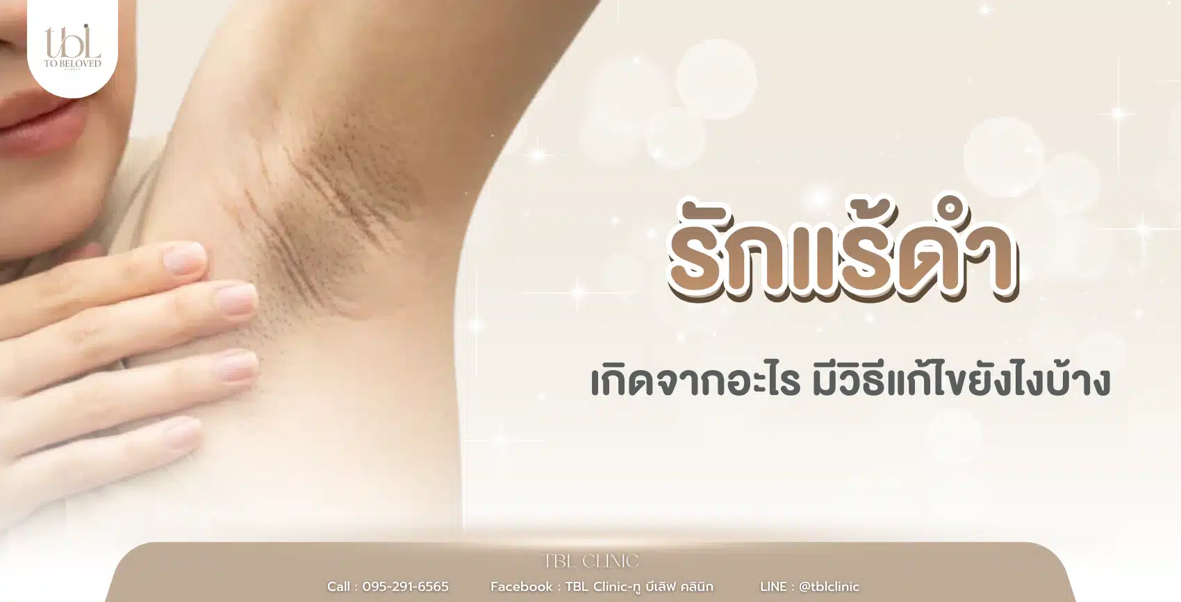 รักแร้ดำ