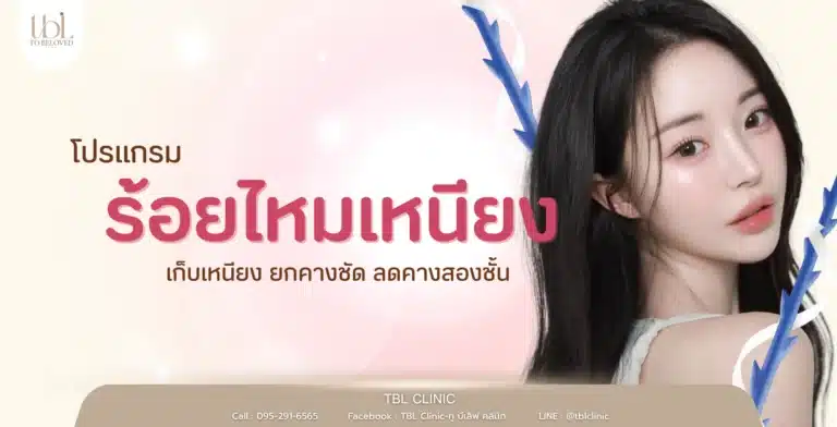 ร้อยไหมเหนียง เก็บเหนียง ยกคางชัด ลดคางสองชั้นแบบเห็นผลทันทีหลังทำ