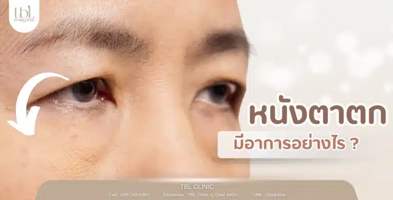 หนังตาตก