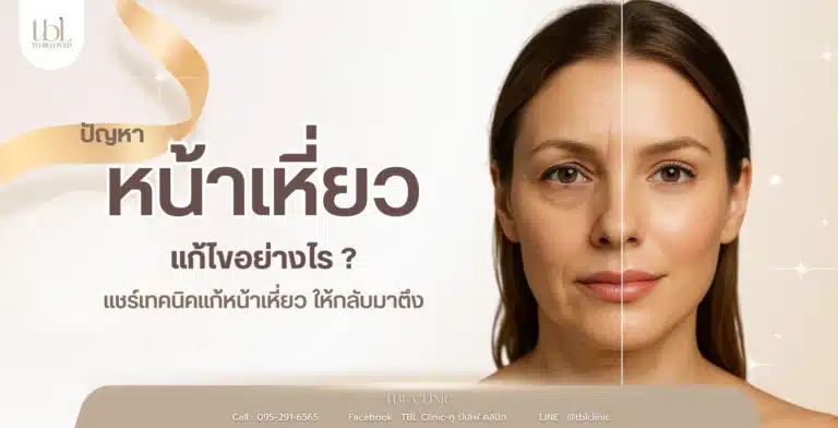 หน้าเหี่ยว