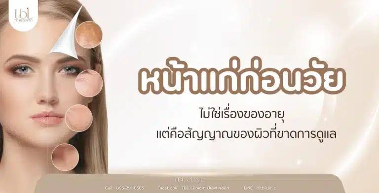 หน้าแก่ก่อนวัย