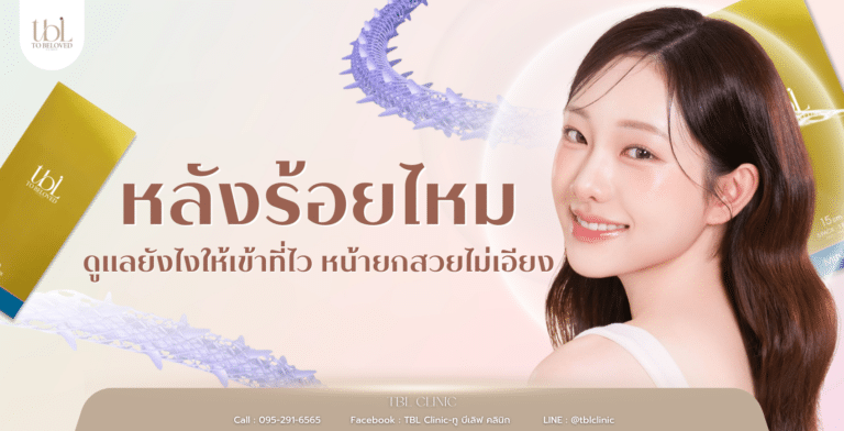 หลังร้อยไหม