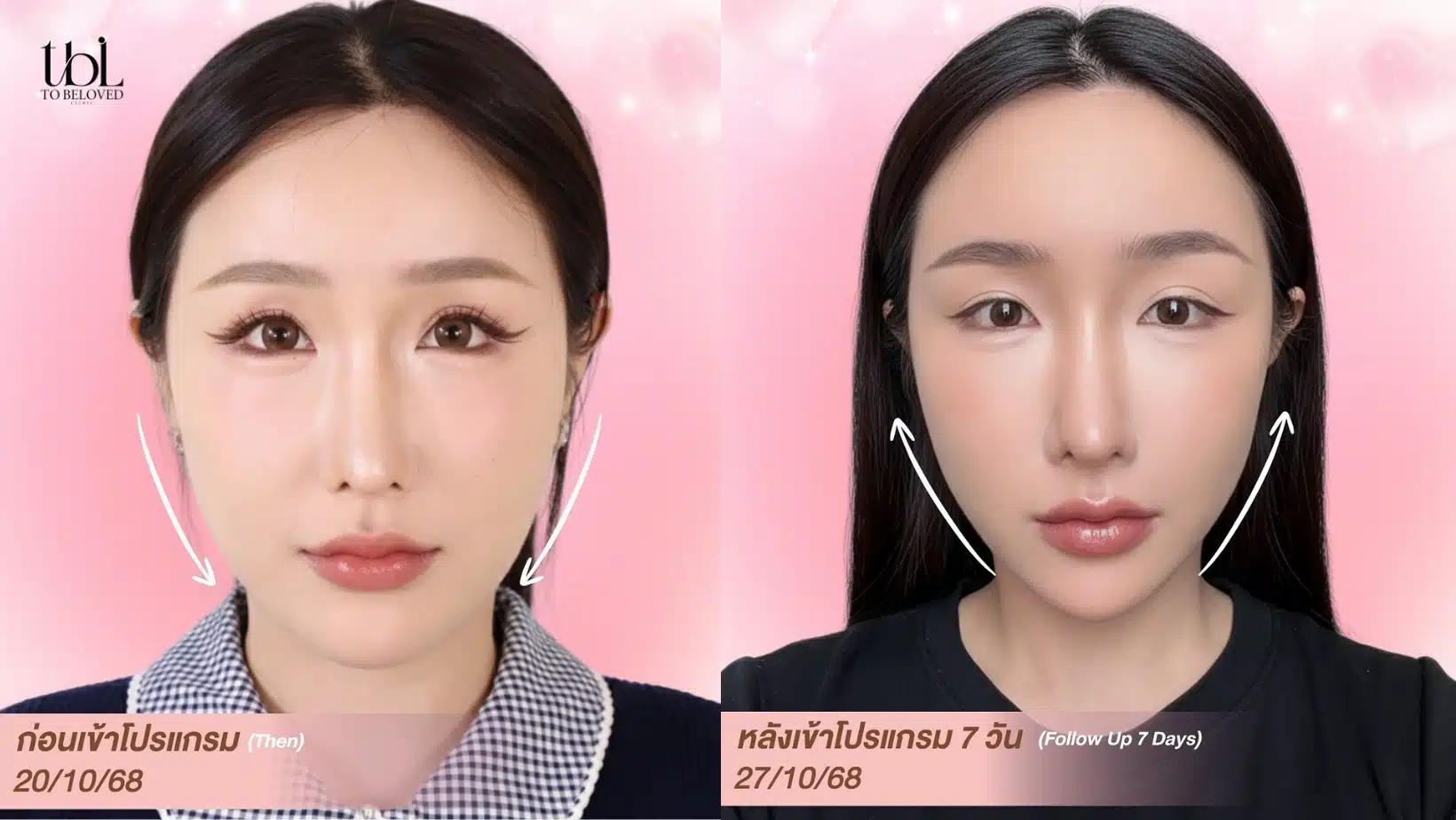 ไหมมิ้น